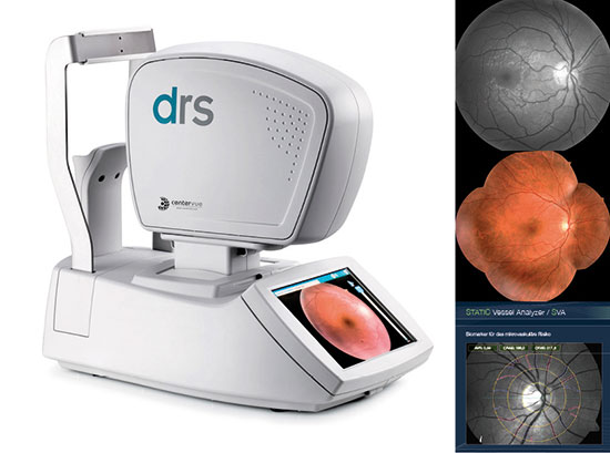 Vollautomatische Funduskamera drs